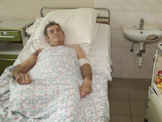 В Мукачево собака искусала своего хозяина: мужчине пришлось ампутировать ногу (видео)