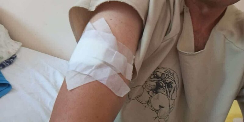 Чемпіона Всесвітньої універсіади з&nbsp;футболу у&nbsp;складі збірної України серйозно поранено на&nbsp;війні з&nbsp;росією (фото)