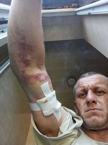 Чемпіона Всесвітньої універсіади з&nbsp;футболу у&nbsp;складі збірної України серйозно поранено на&nbsp;війні з&nbsp;росією (фото)